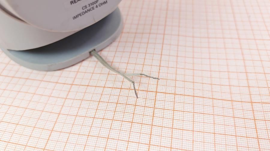 001-076-001 Акустическая система PHILIPS CS 3100P (PEAR RIGHT) #7