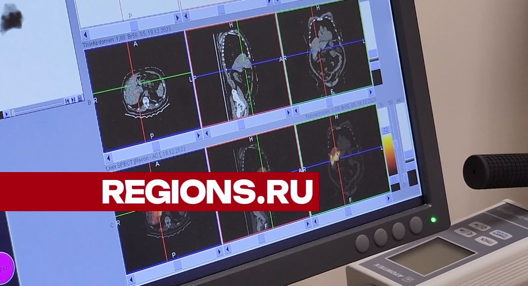 Вторые в России и первые в Подмосковье: в Химках применяется уникальная техника лечения рака печени
