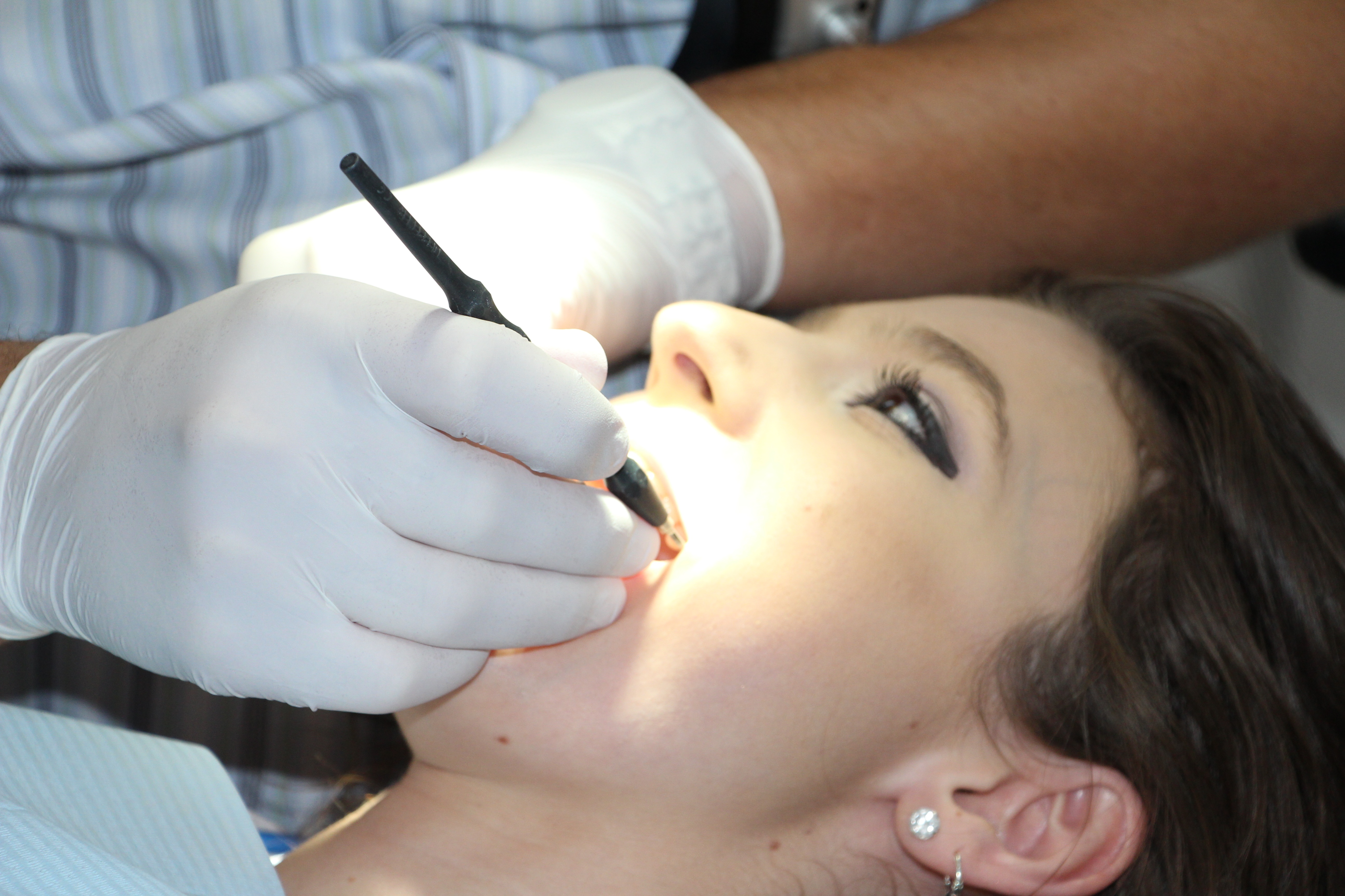 Repair dents. Электрокоагуляция в стоматологии. Электрокоагуляция папиллом. Папиллома в стоматологии.