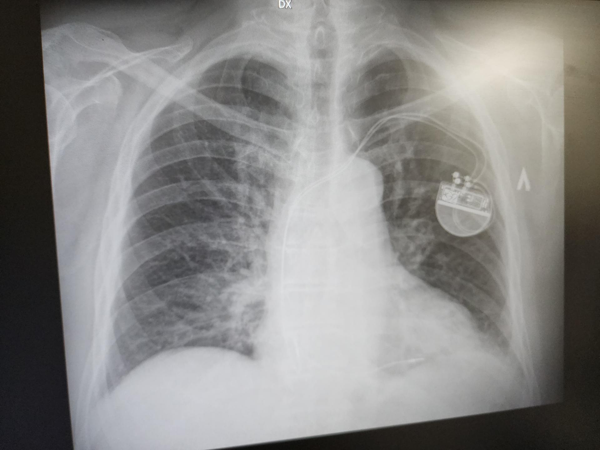 Фото: МедиаБанк Подмосковья/Юлия Унрау