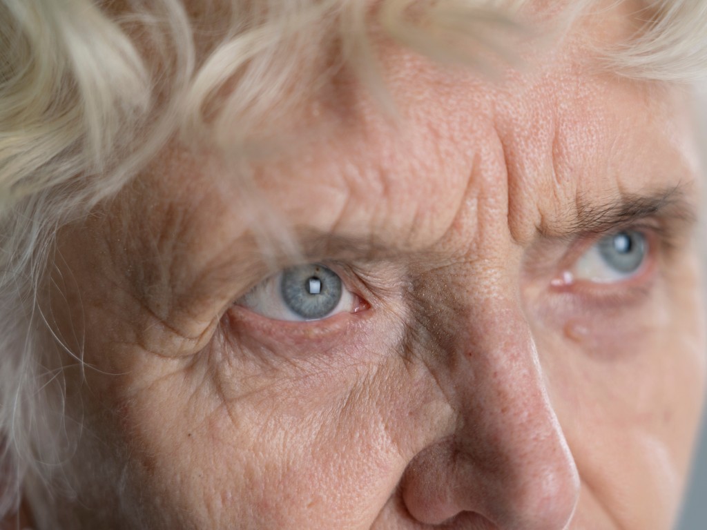 Воскресенские хирурги за полчаса вернули зрение 76-летней пациентке со сложным диагнозом