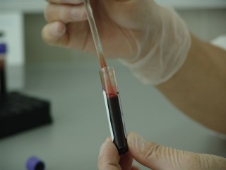 Жители Лотошино могут бесплатно сдать тест на ВИЧ
