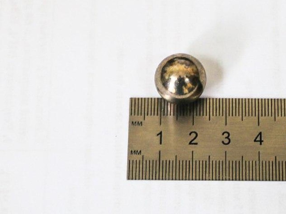 Врачи достали из желудка восьмилетнего школьника металлический шарик