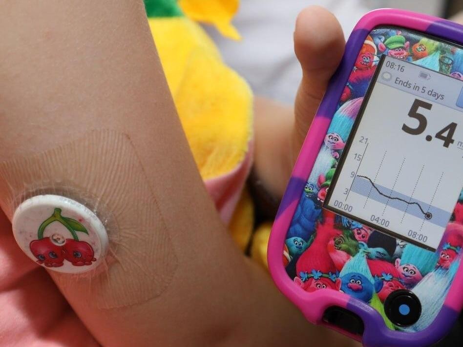 В Подмосковье дети с сахарным диабетом первого типа обеспечены системой мониторинга глюкозы