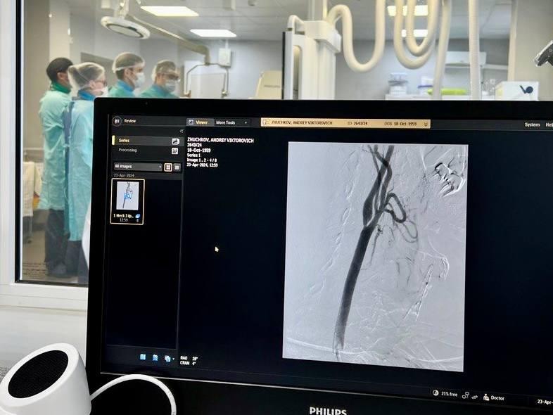 Уникальную операцию на брахиоцефальных артериях головного мозга впервые провели в Дубне