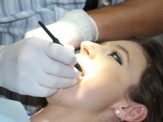 Более 200 льготников округа оформили бесплатное протезирование зубов с начала года