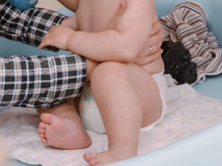 Дисплазию тазобедренных суставов у детей успешно лечат коломенские ортопеды