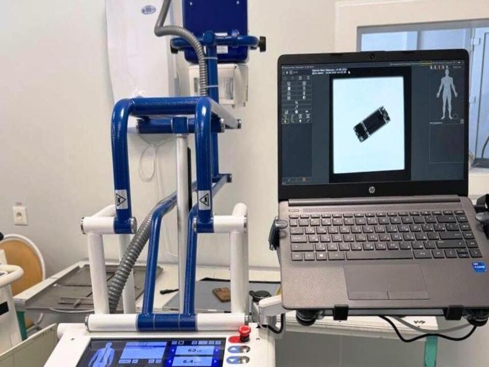 Новое оборудование будут использовать при диагностике «тяжелых» пациентов в Кашире
