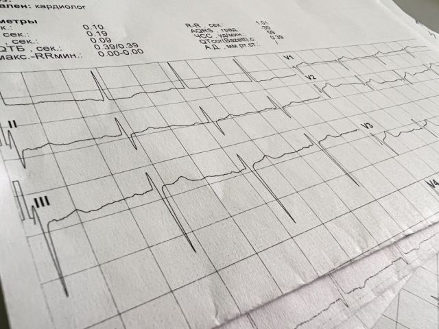 Видновский кардиолог рассказал, при каком пульсе возрастает риск внезапной смерти