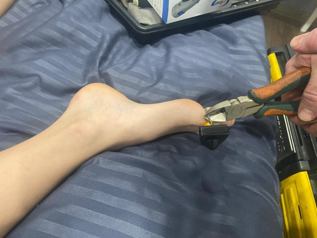 Луховицкие спасатели освободили палец подростка из металлического плена