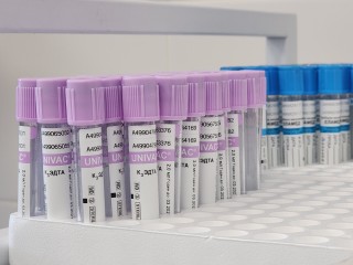 Для жителей поселков Черноголовки проведут бесплатный медосмотр