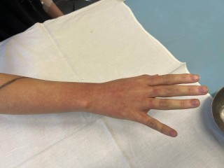 Девочка из Раменского провела два дня в реанимации после укуса змеи
