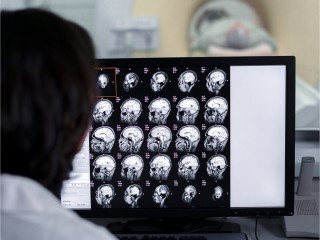Как врачи Долгопрудного спасли жизнь пациентке с опухолью головного мозга