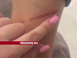Владельцы пострадавших от амстаффа собак в Красногорске собираются подать жалобу