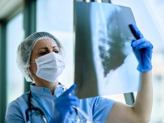 Смертность от туберкулеза снизилась на 60% за десятилетие