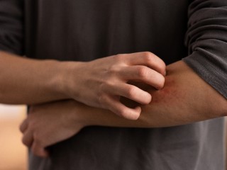 В Подмосковье зафиксированы случаи зуда купальщика