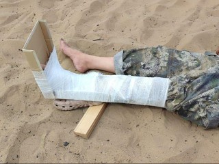 Спасатели оказали помощь женщине, повредившей ногу на пляже в Дубне