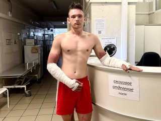 Химические ожоги получил кадет в Подмосковье
