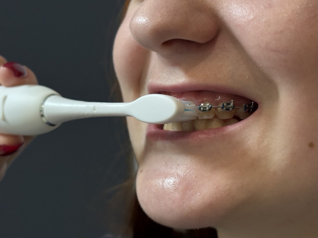 Электрические зубные щетки оказались эффективнее обычных