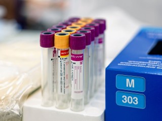Появился тест, который проверяет иммунитет к холере у человека