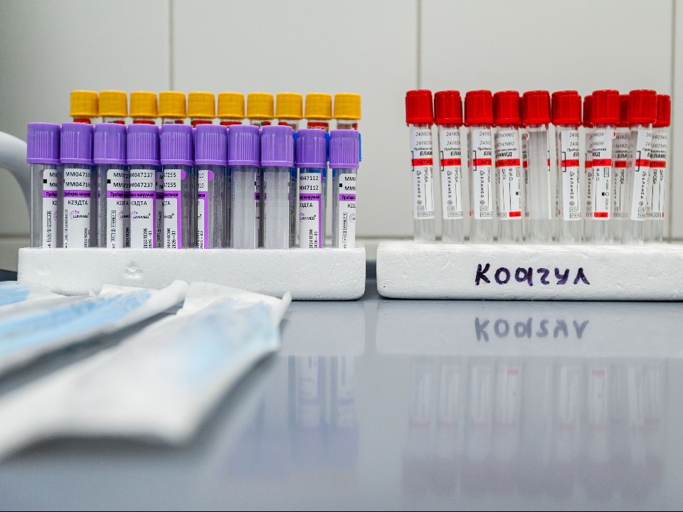 Какие действия недопустимы перед сдачей анализов мочи и крови