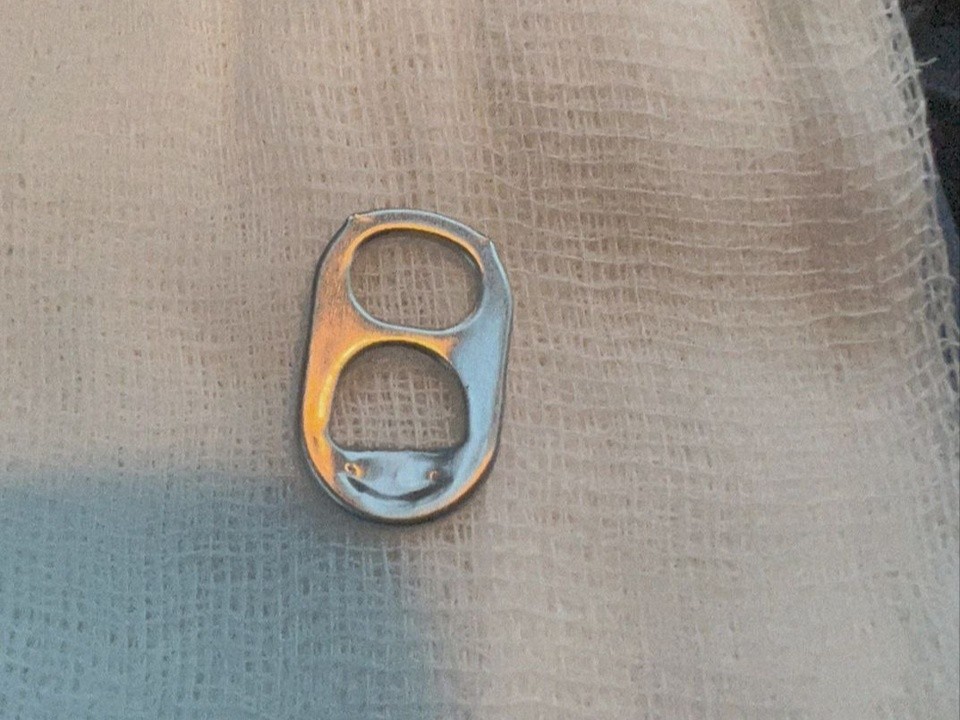 Открывашку от пивной банки достали раменские врачи из желудка годовалого ребенка