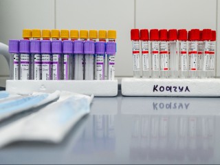 Какие действия недопустимы перед сдачей анализов мочи и крови