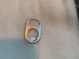 Открывашку от пивной банки достали раменские врачи из желудка годовалого ребенка