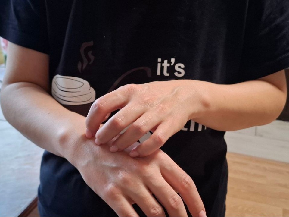 Псориаз: что нужно знать каждому, рассказали видновские врачи