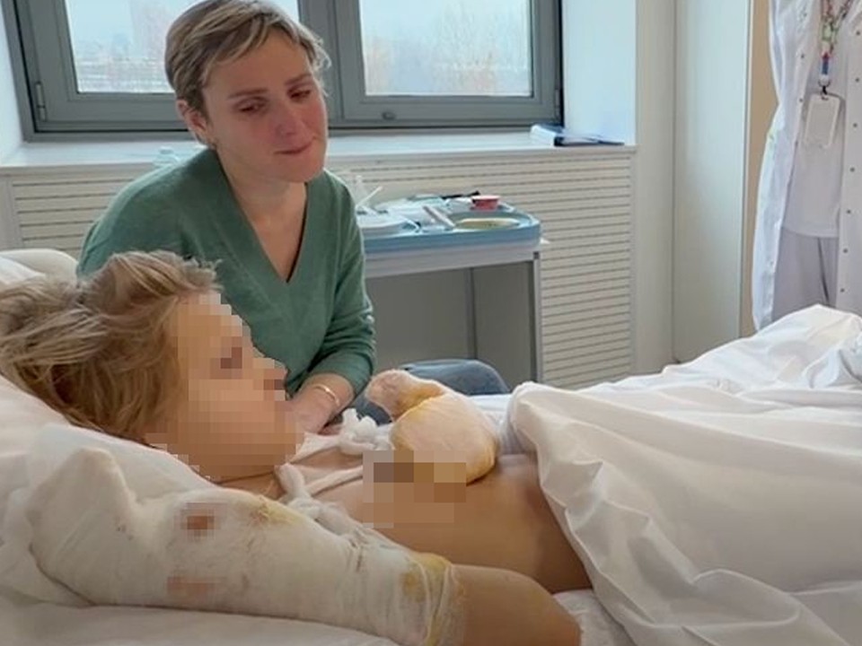 В Красногорске мальчику разорвало руку СВУ: реакция властей и версии