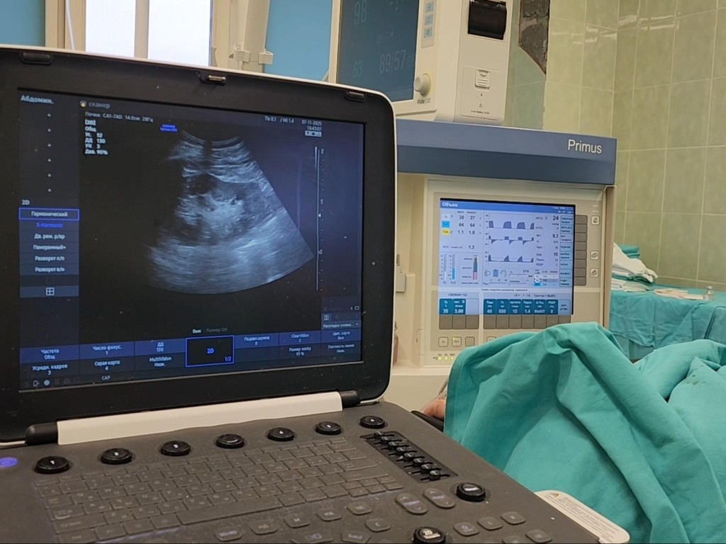 Тихий убийца почек: что приводит к гниению органа и как остановить эту невидимую угрозу