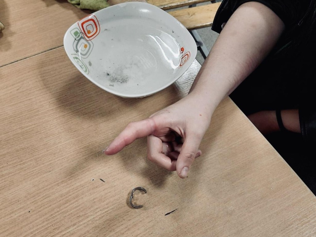 Спасатели сняли застрявшее кольцо с пальца девушки в Богородском округе