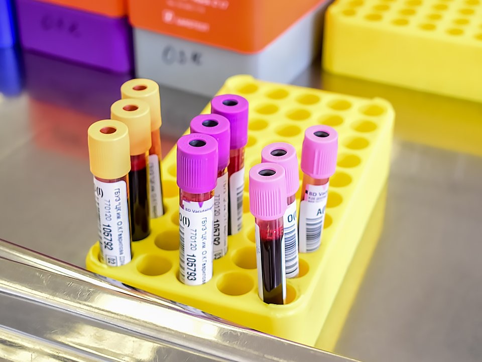 Врачи Одинцова объявили Донорскую субботу