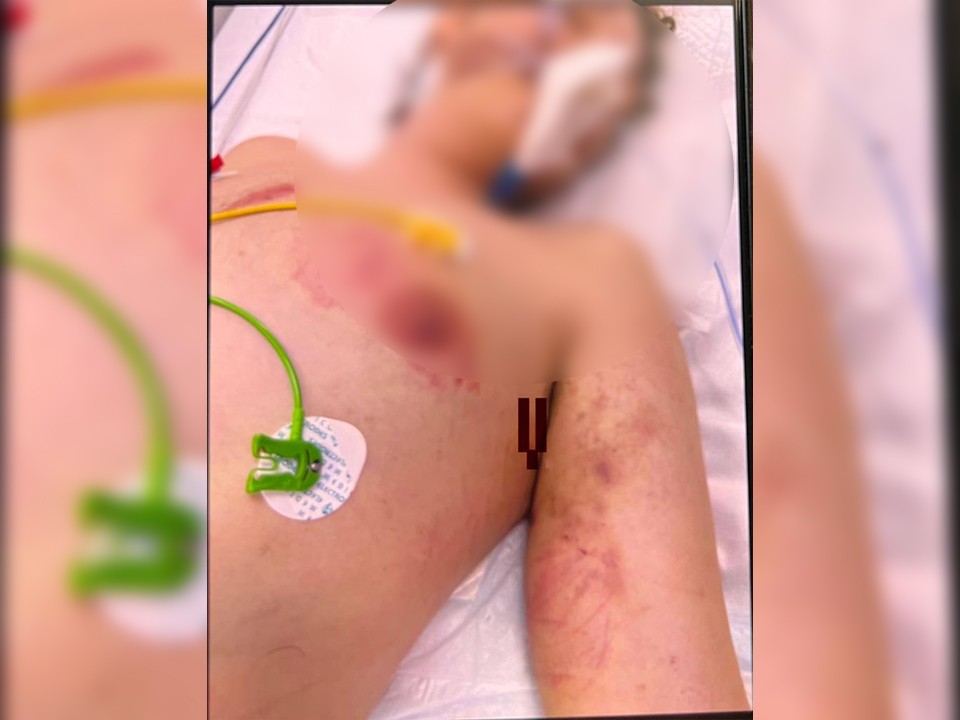 Что известно о детском рехабе в Подмосковье, где подросток попал в кому из-за избиений