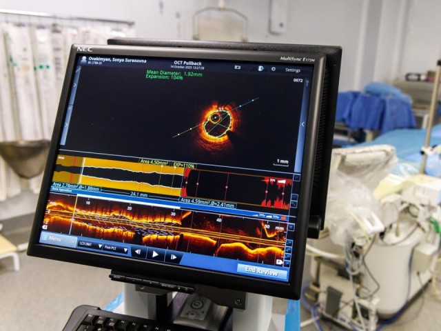 Ювелирная точность в сердце: в Люберцах начали ставить стенты с помощью суперсистемы визуализации