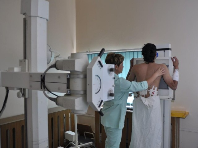 От курения до туберкулеза: кто в Подмосковье находится в группе повышенного риска по раку легких?