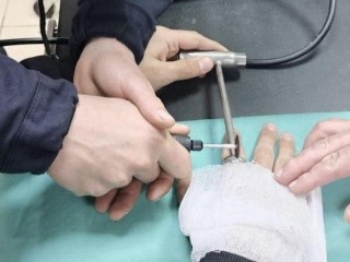 Спасатели сняли тесное кольцо с пальца подростка в Волоколамске