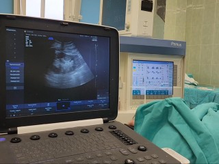 Тихий убийца почек: что приводит к гниению органа и как остановить эту невидимую угрозу