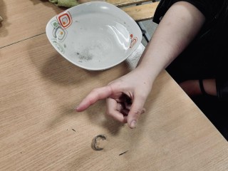 Спасатели сняли застрявшее кольцо с пальца девушки в Богородском округе