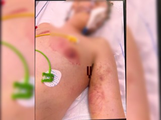 Что известно о детском рехабе в Подмосковье, где подросток попал в кому из-за избиений