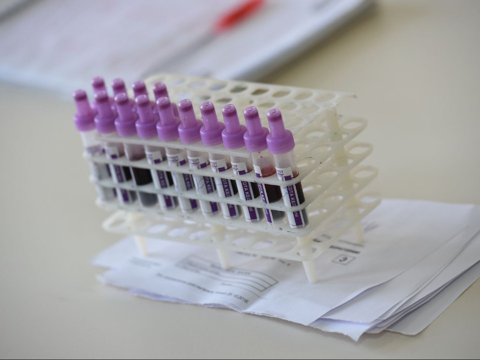 Современные методы диагностики позволили провести 32 тыс. тестов на ВИЧ в Коломне
