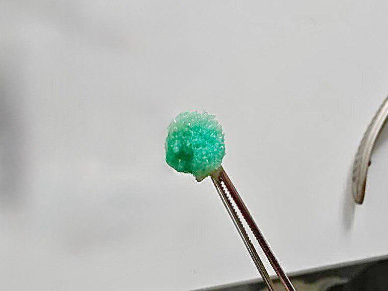 Видновский врач достал из носа девочки кусок губки для мытья посуды