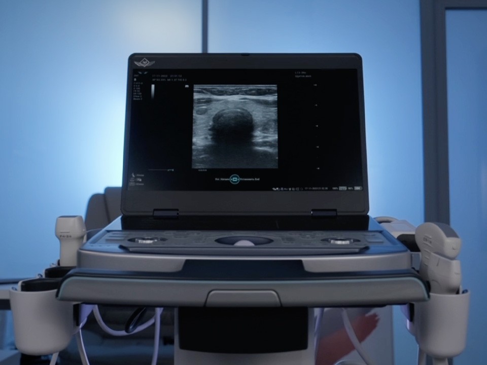Аппараты УЗИ для полевых условий разработали в Подмосковье