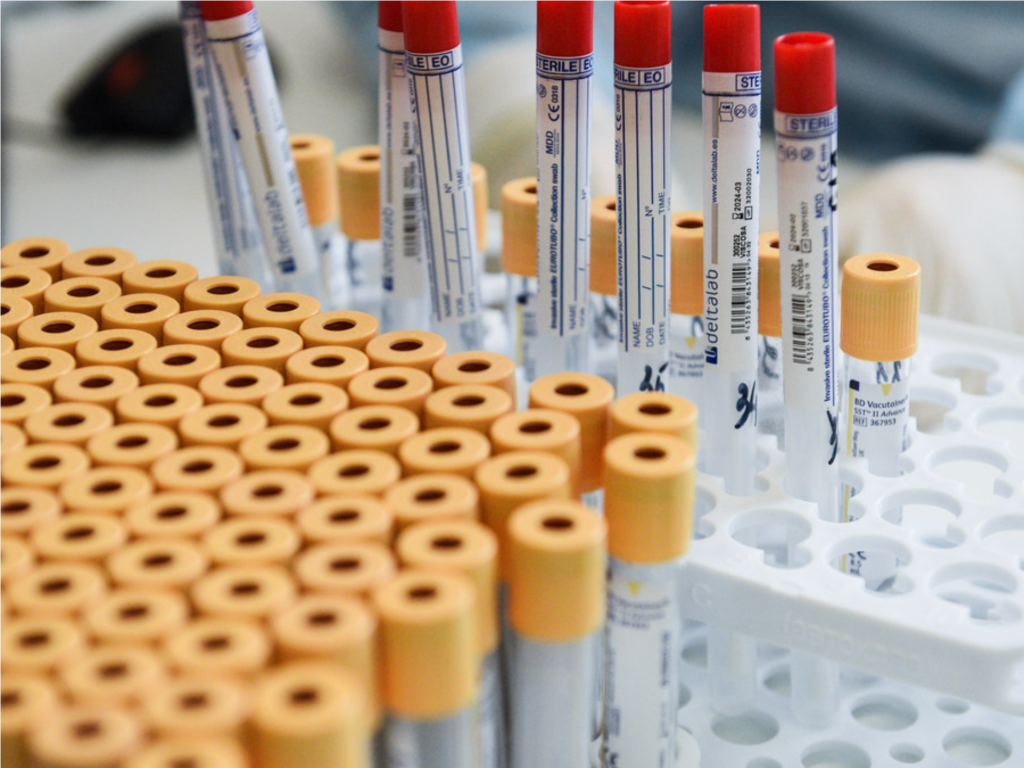 В Мытищах получить лечение смог 71 человек с ВИЧ после профилактической проверки