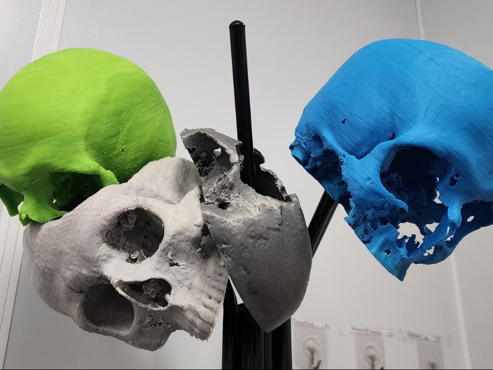 Нейрохирург из Истры печатает черепа на 3D‑принтере и спасает пациентов в сложных случаях