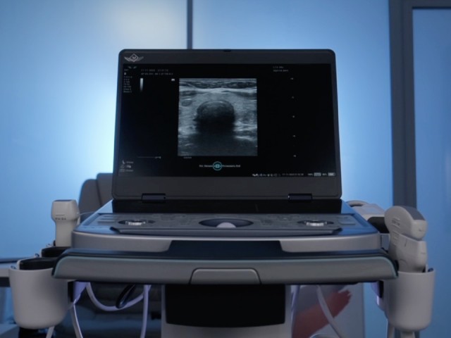 Аппараты УЗИ для полевых условий разработали в Подмосковье