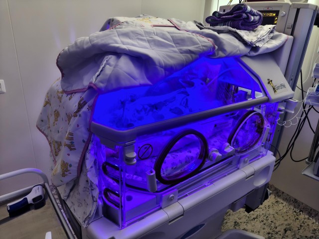 В Наро-Фоминске спасли и выходили новорожденную с экстремально низким весом