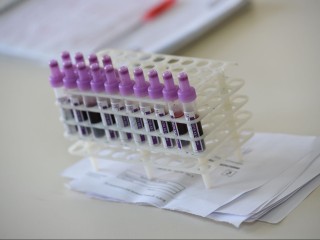 Современные методы диагностики позволили провести 32 тыс. тестов на ВИЧ в Коломне