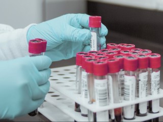 Пройти тестирование — значит выбрать жизнь: как обстоят дела с заболеваемостью СПИДом в Подмосковье