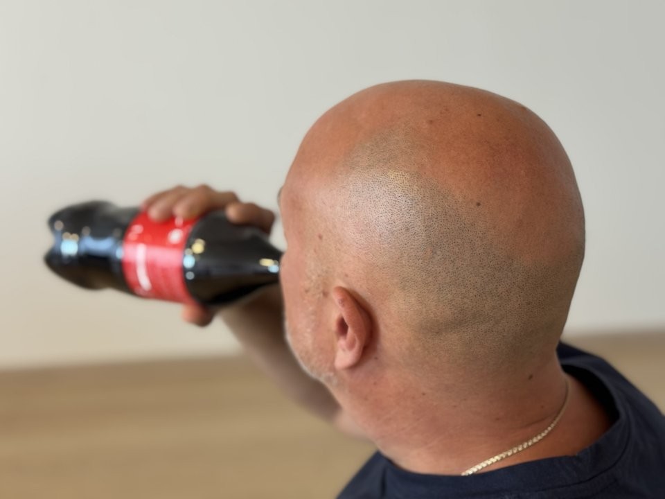 Две популярные привычки: от чего чаще всего развивается мужское бесплодие